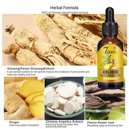 Fast Ginger Growth Hair Oil Treatment Anti Hair Loss Men&Women + Scalp Treatment